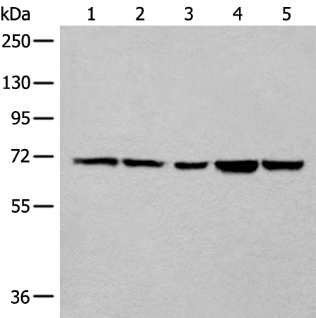 Anti-Collagen XXV alpha 1 Rabbit Polyclonal Antibody
