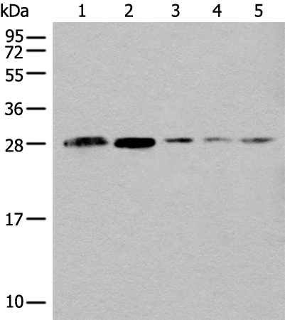 Anti-CLPP Rabbit Polyclonal Antibody