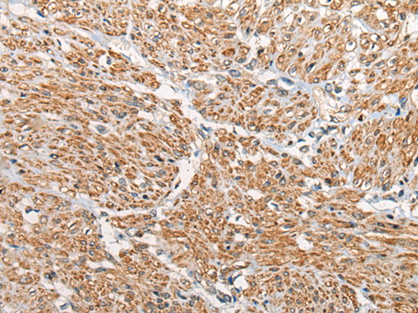 Anti-MKK7 Rabbit Polyclonal Antibody