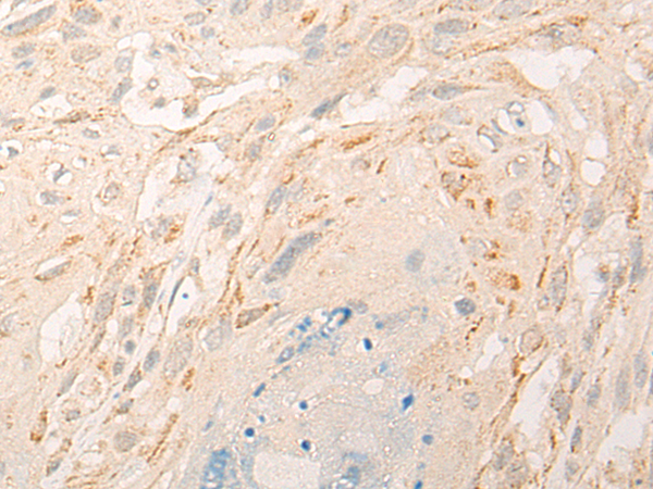 Anti-ALDH7A1 Rabbit Polyclonal Antibody