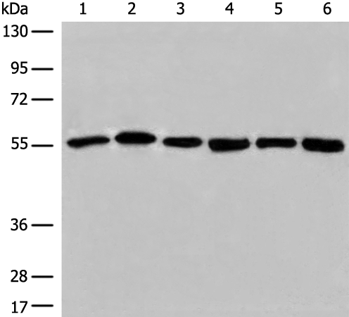 Anti-ALDH7A1 Rabbit Polyclonal Antibody