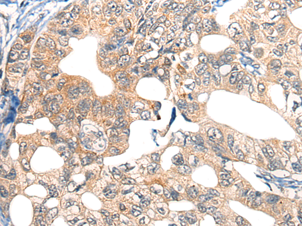 Anti-Ephrin Receptor A6 Rabbit Polyclonal Antibody