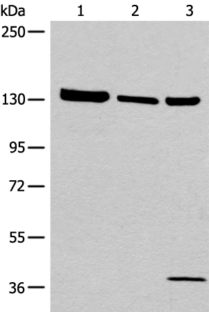 Anti-Ephrin Receptor A6 Rabbit Polyclonal Antibody