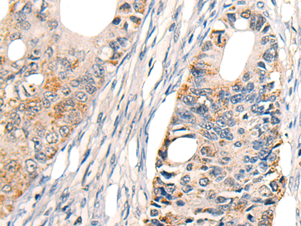Anti-TNFRSF10D Rabbit Polyclonal Antibody
