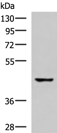 Anti-TNFRSF10D Rabbit Polyclonal Antibody