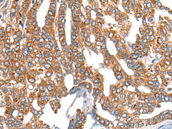 Anti-CBP80 Rabbit Polyclonal Antibody