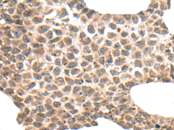 Anti-DYRK1A Rabbit Polyclonal Antibody