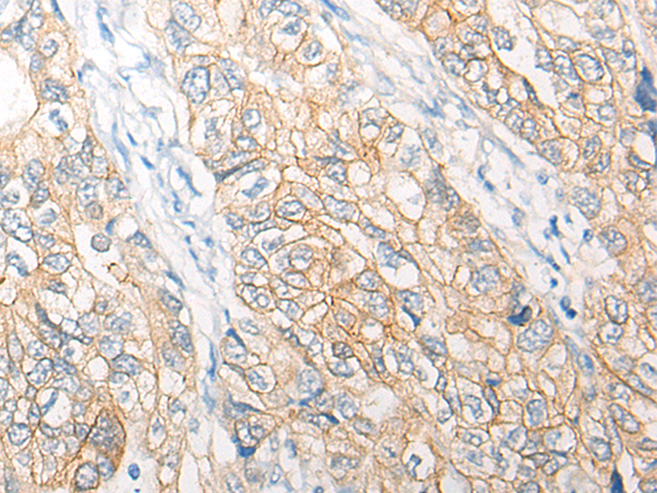 Anti-PNPO Rabbit Polyclonal Antibody