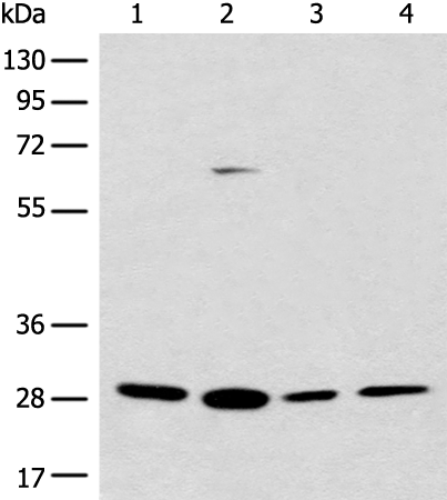 Anti-PNPO Rabbit Polyclonal Antibody