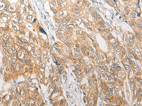 Anti-RGN Rabbit Polyclonal Antibody
