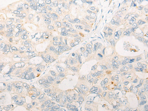 Anti-CCNJ Rabbit Polyclonal Antibody
