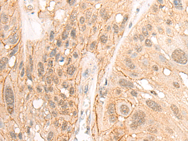 Anti-HOXA10 Rabbit Polyclonal Antibody