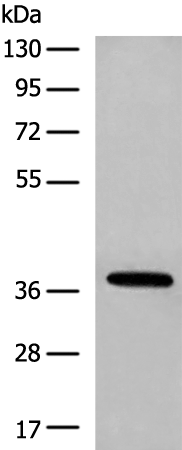 Anti-HOXA10 Rabbit Polyclonal Antibody