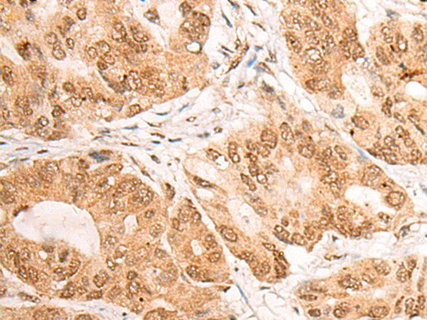 Anti-Lipin 1 Rabbit Polyclonal Antibody