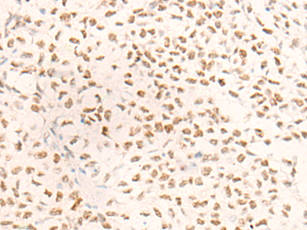 Anti-MSH2 Rabbit Polyclonal Antibody