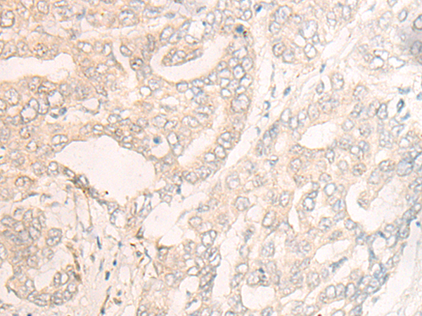 Anti-CLIP2 Rabbit Polyclonal Antibody