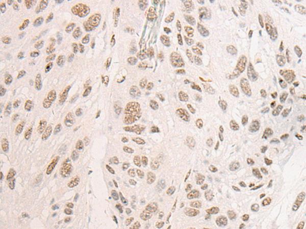 Anti-Cytochrome P450 2A13 Rabbit Polyclonal Antibody