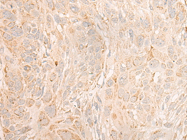 Anti-Cytochrome C Oxidase subunit Vic Rabbit Polyclonal Antibody