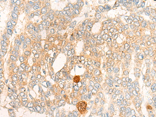 Anti-DBT Rabbit Polyclonal Antibody
