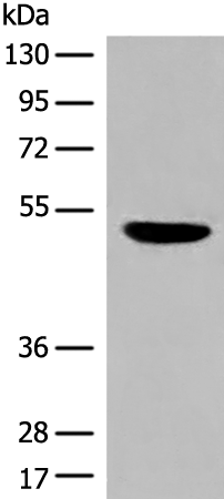 Anti-DBT Rabbit Polyclonal Antibody