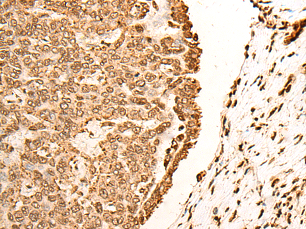 Anti-H2BC1 Rabbit Polyclonal Antibody