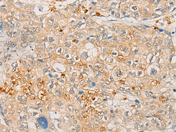Anti-FBXO32 Rabbit Polyclonal Antibody