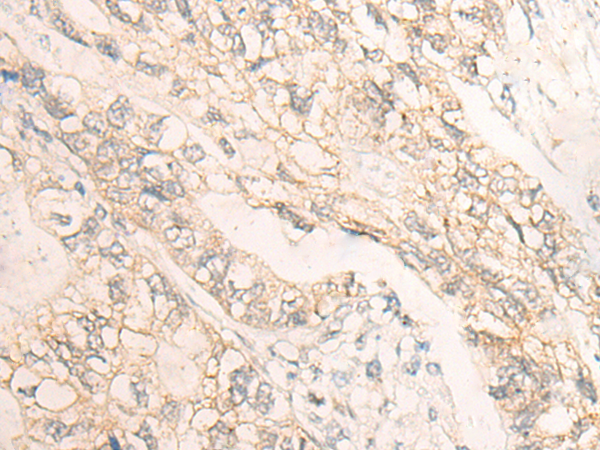 Anti-DMTN Rabbit Polyclonal Antibody
