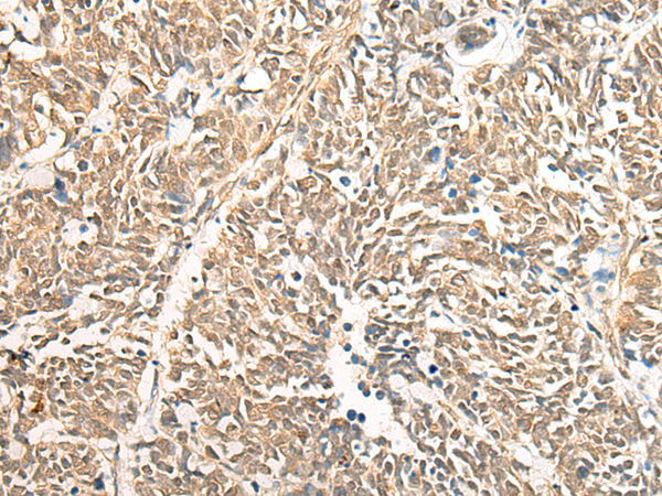 Anti-DGCR6 Rabbit Polyclonal Antibody