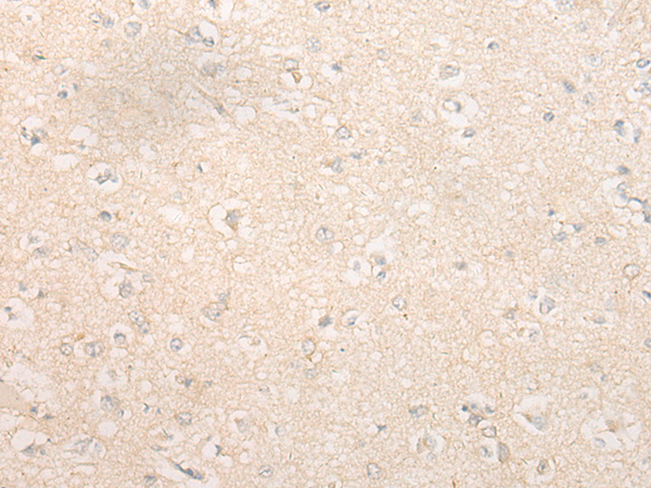 Anti-DIP2 Homolog B Rabbit Polyclonal Antibody