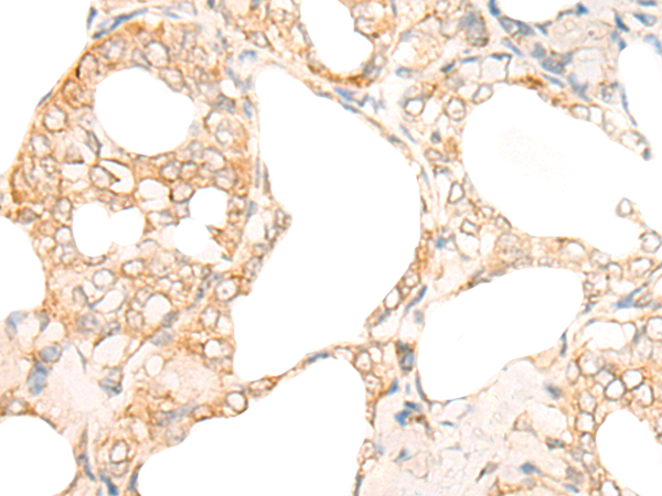 Anti-DMAP1 Rabbit Polyclonal Antibody