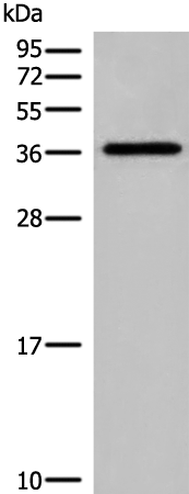 Anti-DNAJC9 Rabbit Polyclonal Antibody