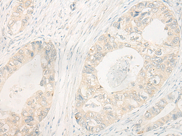 Anti-DUSP5 Rabbit Polyclonal Antibody