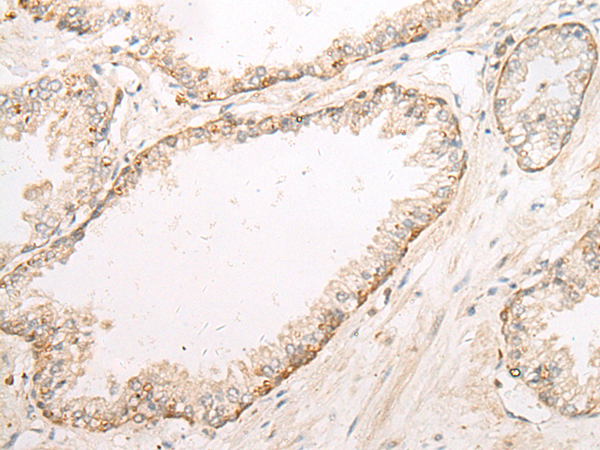 Anti-DYNC1LI2 Rabbit Polyclonal Antibody