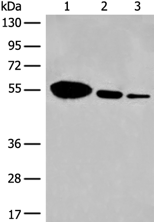Anti-DYNC1LI2 Rabbit Polyclonal Antibody
