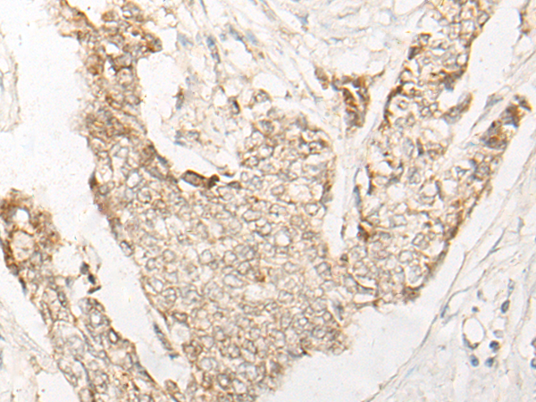 Anti-EEPD1 Rabbit Polyclonal Antibody