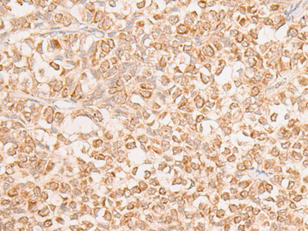 Anti-EN2 Rabbit Polyclonal Antibody