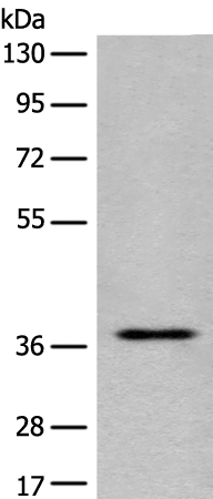 Anti-EN2 Rabbit Polyclonal Antibody