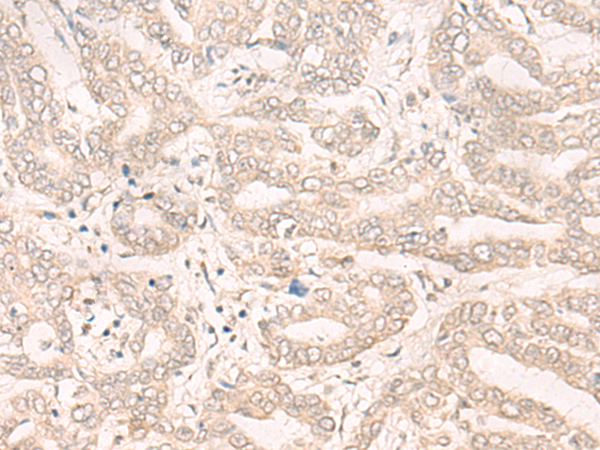Anti-ENO4 Rabbit Polyclonal Antibody