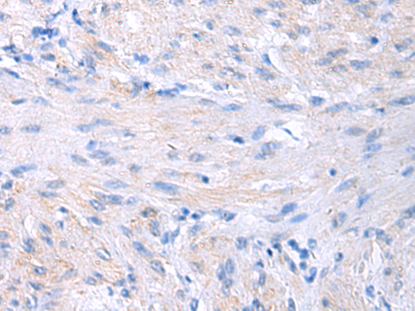 Anti-PROC Rabbit Polyclonal Antibody
