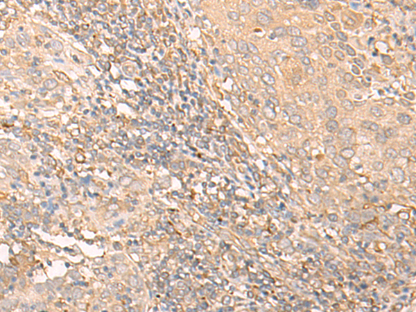Anti-IL-34 Rabbit Polyclonal Antibody
