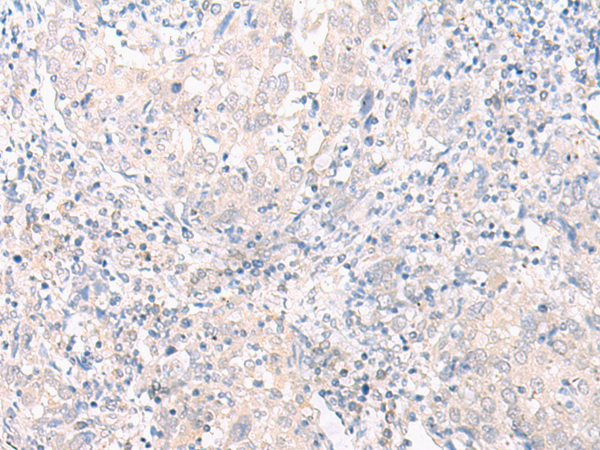 Anti-SLC25A27 Rabbit Polyclonal Antibody