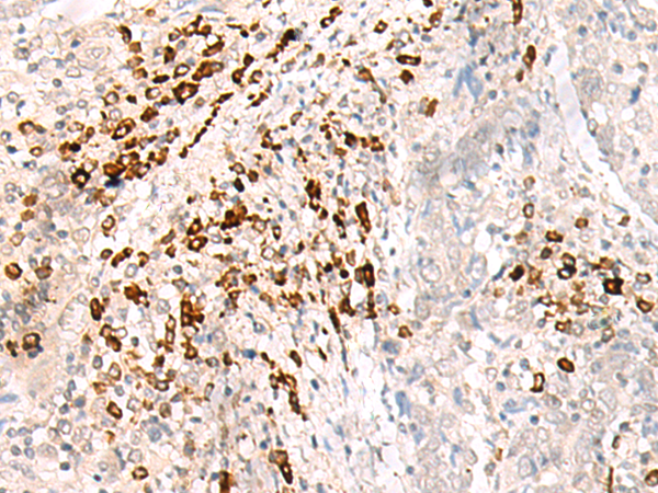 Anti-HLA B Rabbit Polyclonal Antibody