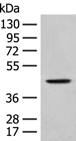 Anti-HLA B Rabbit Polyclonal Antibody