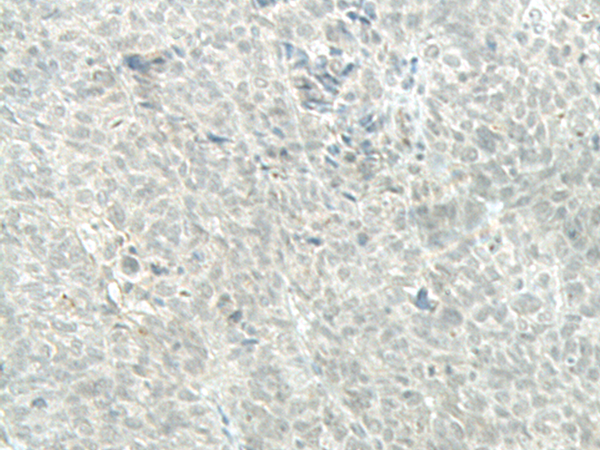 Anti-MECOM Rabbit Polyclonal Antibody