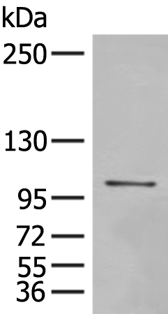 Anti-MECOM Rabbit Polyclonal Antibody