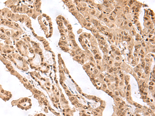 Anti-EXOSC9 Rabbit Polyclonal Antibody