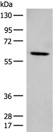 Anti-ME2 Rabbit Polyclonal Antibody