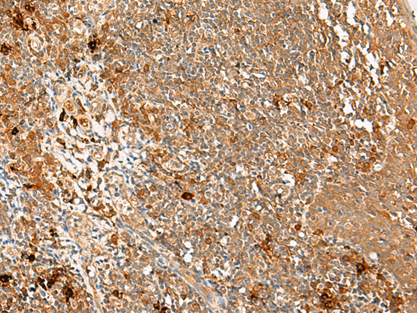 Anti-METTL17 Rabbit Polyclonal Antibody