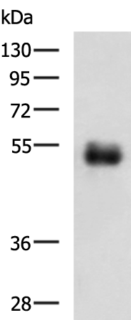 Anti-METTL17 Rabbit Polyclonal Antibody