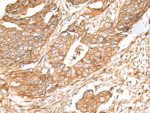 Anti-FAM155B Rabbit Polyclonal Antibody